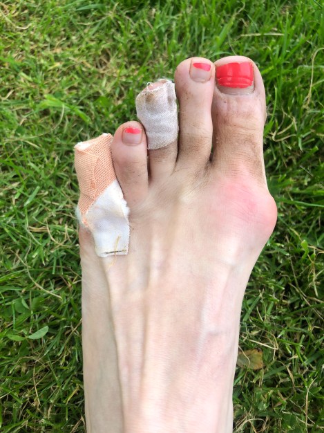 I can't nap, I need to tend to my feet which are a little worse for wear... already!